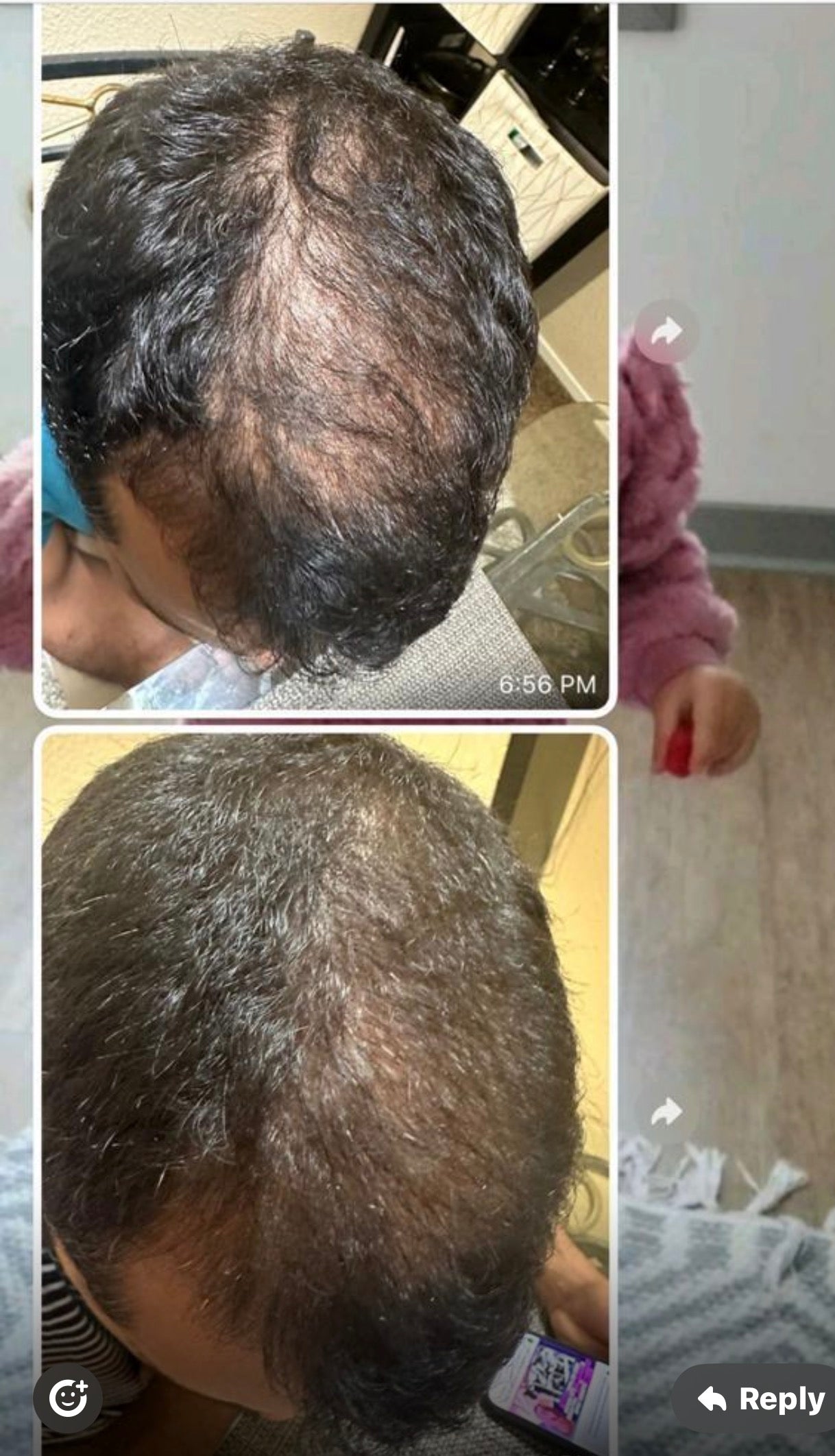 Mirra Capsitrat Anti-hair Loss Treatment Kit